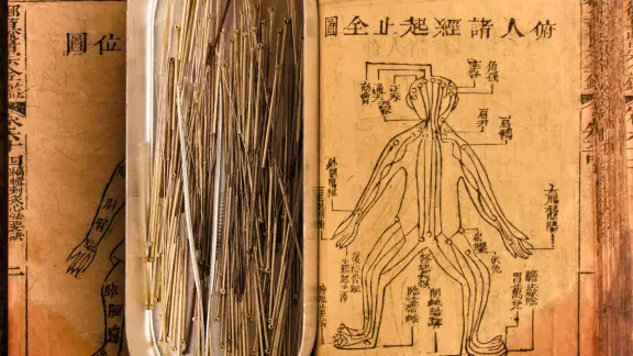 Fine acupuncture needles beside a traditional Chinese meridian chart